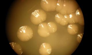Colonie di batteri Serratia ficaria SH7. Credit ENEA